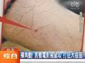 臺(tái)北一男看電影被鼠咬 打狂犬疫苗